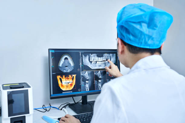 Best Knocked-Out Tooth (Avulsed Tooth) Treatment in Lincolnton, GA